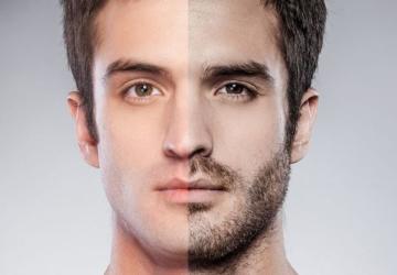 زراعة اللحية في تركيا