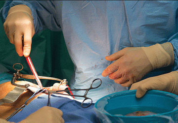 مستشفيات زراعة الكلى في تركيا تستخدم تقنيات متطورة لإجراء العملية مريحة للمرضى