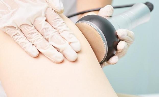 شفط الدهون بالفيزر في تركيا