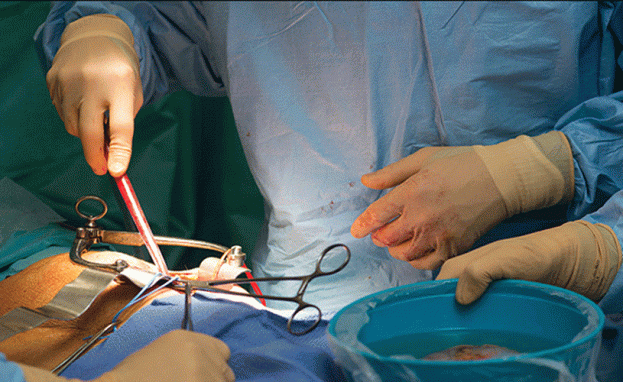 مستشفيات زراعة الكلى في تركيا تستخدم تقنيات متطورة لإجراء العملية مريحة للمرضى